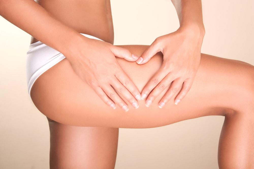 Causes, Treatments and Prevention of Cellulite