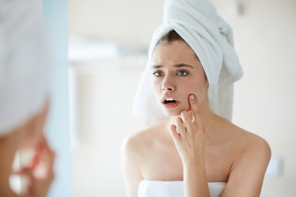 Skin Care Habits That Worsen Acne, Part 1
